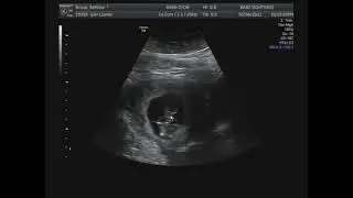 Baby Bruce 5/4/21 (NO AUDIO)