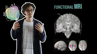 Visualizing the brain - functional neuroimaging