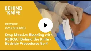 Stop Massive Bleeding (Abdominal and Pelvic) with REBOA | Behind the Knife - Bedside Procedures Ep 4