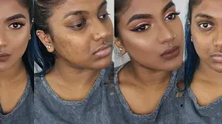 FLAWLESS FOUNDATION ROUTINE FOR OILY ACNEIC SKIN | COVER ACNE SCARS & KEEP FACE MATTE ALL DAY