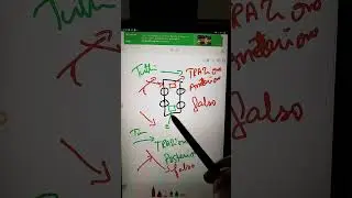 Trazione Anteriore e Trazione Posteriore ? Quiz