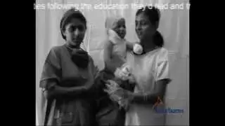 Prevention of paediatric burns in the community
