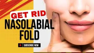 GET RID OF NASOLABIAL FOLDS /LAUGH LINE
