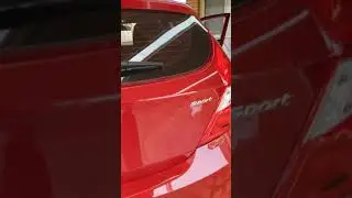 2018 Hyundai accent integrated reverse camera 😎