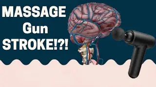 Massage gun caused a stroke!