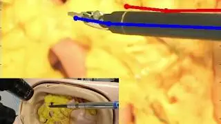 Hand-Eye Calibration of Robotic Surgical Instrument Using Interactive Manipulation