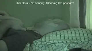 Zquiet Versus Sleep Apnea Snoring. Stop Snoring Mouthpiece Review. Live Results! 2020