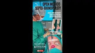 SEPTO-RHINOPLASTY | AUGMENTATION | WIDE NOSE RHINOPLASTY | SADDLE NOSE DEFORMITY |