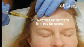 Hair Loss: PRP [platelet-rich plasma] treatments