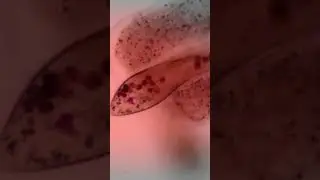 Amoeba captures paramecium 6 #shorts