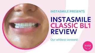 Our brightest shade of clip-on veneer! BL1 instasmile review