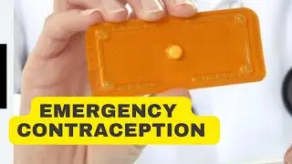 Emergency Contraception: How To Prevent Pregnancy After An Unprotected Sex.
