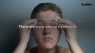 Acne - What Does Acne Treatment Really Work? - Acne & Skin Care