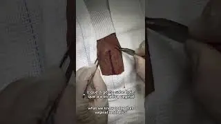 Estética dos Grandes Lábios