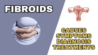 What Causes Uterine Fibroids - Symptoms, Diagnosis and Treatment