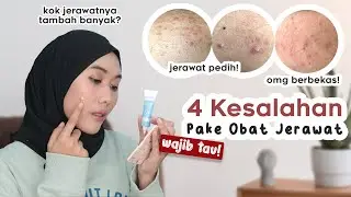 4 Kesalahan Pakai Obat Jerawat Yang Bikin Jerawat Tambah Parah