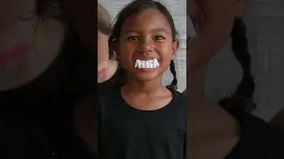 What do you get when you cross a snowman and a vampire?  | Jokes for kids