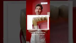 ¿Por qué se tuercen los dientes?🤔 | El Dr. Carlos Granja te lo cuenta
