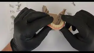 Easy Chairside Bars Using the Quikbar System