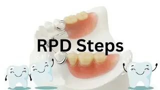 RPD step by step procedure (SIMPLIFIED)