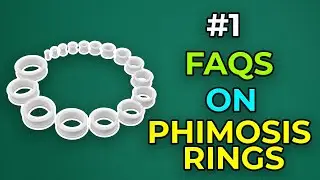 Frequently Asked Questions on Phimosis Rings