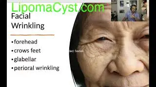 Skin Aging and Treatment- Dr Khaled Sadek Live Chat  6th August 2023.