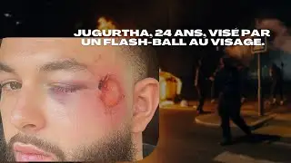 Jugurtha, 24 ans, visé par un tir de flash-ball au visage pendant les révoltes à Rueil-Malmaison.