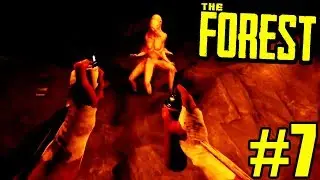 Used Hair Spray Flamethrower On Virginia Boss! - The Forest Co-op Part 7