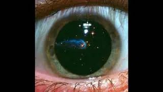 (free) TAME IMPALA + RADIOHEAD TYPE BEAT - "With Open Eyes"
