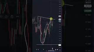The BEST Price Action Pattern that worldchampions trade