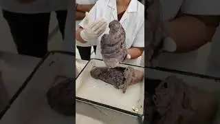 Lung anatomicl position nd side determination