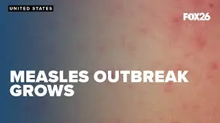Measles outbreak grows Nationwide, what it means for public health