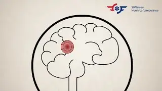 Lær deg førstehjelp ⎮ Hjerneslag - kjenn tegnene og ring 1-1-3