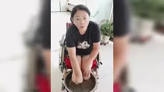 Amputee Lady Stump Care | DBK Amputee Woman in Wheelchair | Amputada