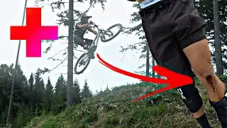 HORROR CRASH an den Wexl Trails 🤕