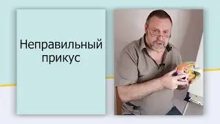 Нарушение прикуса, криво растут зубы. Как возникает? Как это лечить?