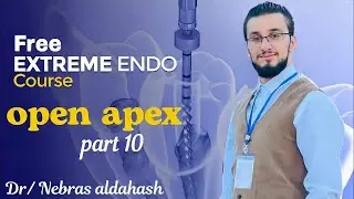 Management Of immature Tooth || Open apex