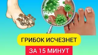 Лучшее средство от ГРИБКА НОГТЕЙ. Это копеечное средство уберет грибок ногтей.