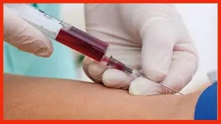 Extracción de Sangre con Jeringa✅ (Toma de Muestra Sanguínea)