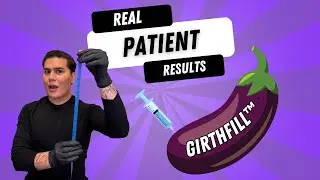 GirthFill™ Before & After | Real Penis Filler Results