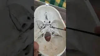 anterior of skull | anterior crinal fossa | middle and posterior crinal fossa|part 5