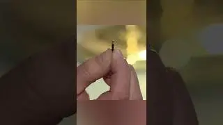 RFID Chips In Hand? 😨