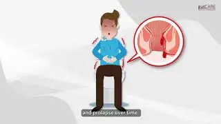 Haemorrhoids 101 | GUTCARE