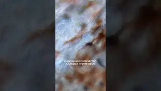 Там где нет движения - нет жизни и здоровья