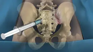 Средневековые пытки отдыхают.
