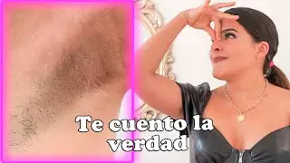 Depilacion definitiva IPL Axilas - FUNCIONA? Mi experiencia 1 año después con fotos y videos (Q&A)