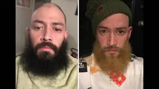 Midlife Crisis (Beard dying)