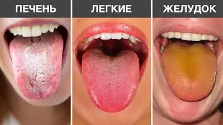 9 сигналов, Которые Ваш ЯЗЫК ПОСЫЛАЕТ вам о надвигающихся ОПАСНОСТЯХ с телом