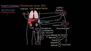 Polisitemia Vera Nedir? (Fen Bilimleri) (Sağlık ve Tıp)