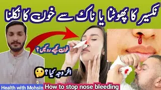 Naak se khoon ana | Nose bleeding treatment |Naak se khon Aane ka ilaj | epistaxis treatment | nose|